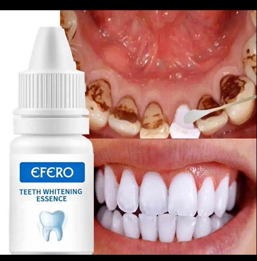 Sérum de nettoyage liquide et blanchiment des dents.