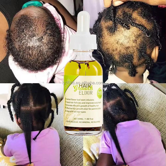 Hair Growth Elixr